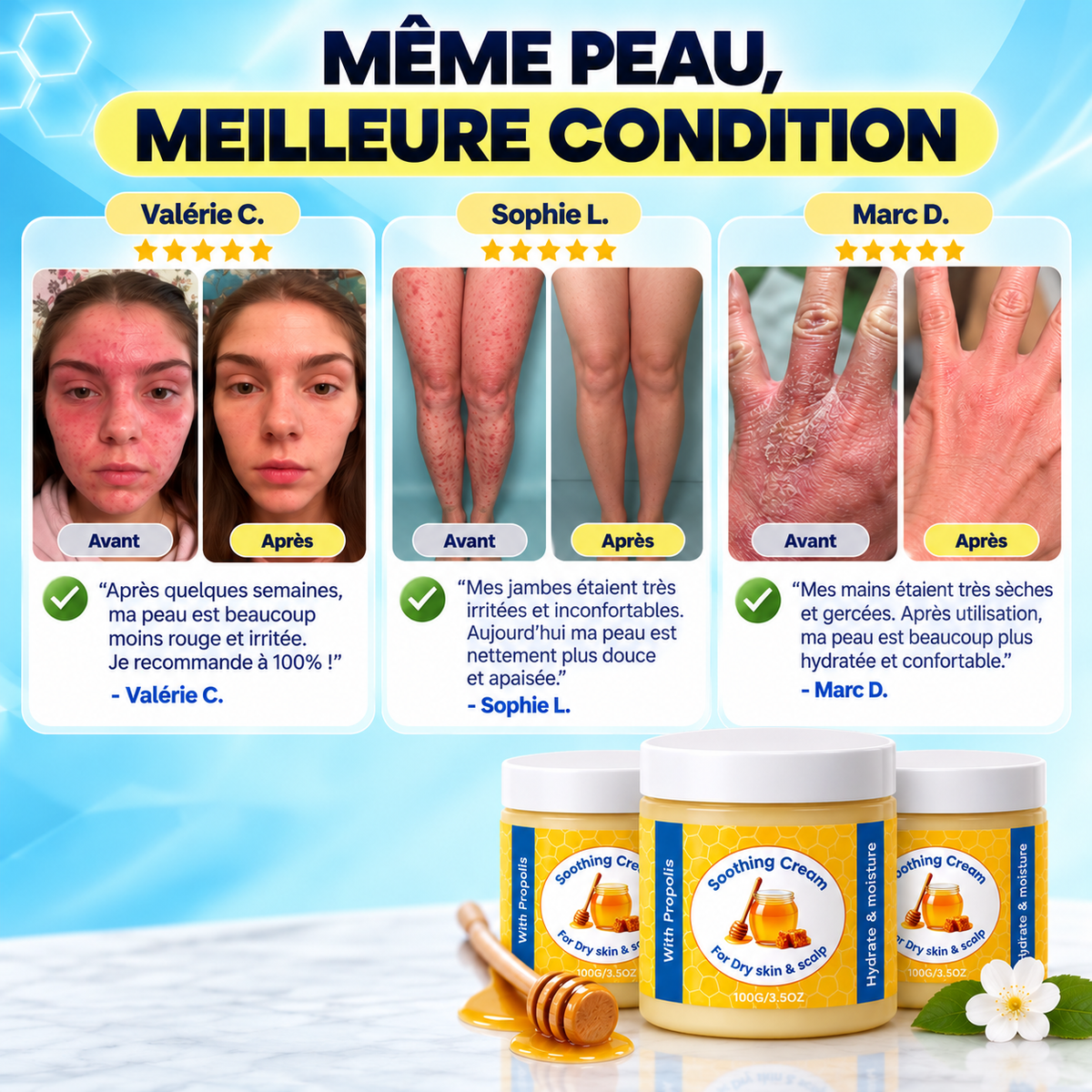 Baume Ondine – Soin naturel pour eczéma et psoriasis