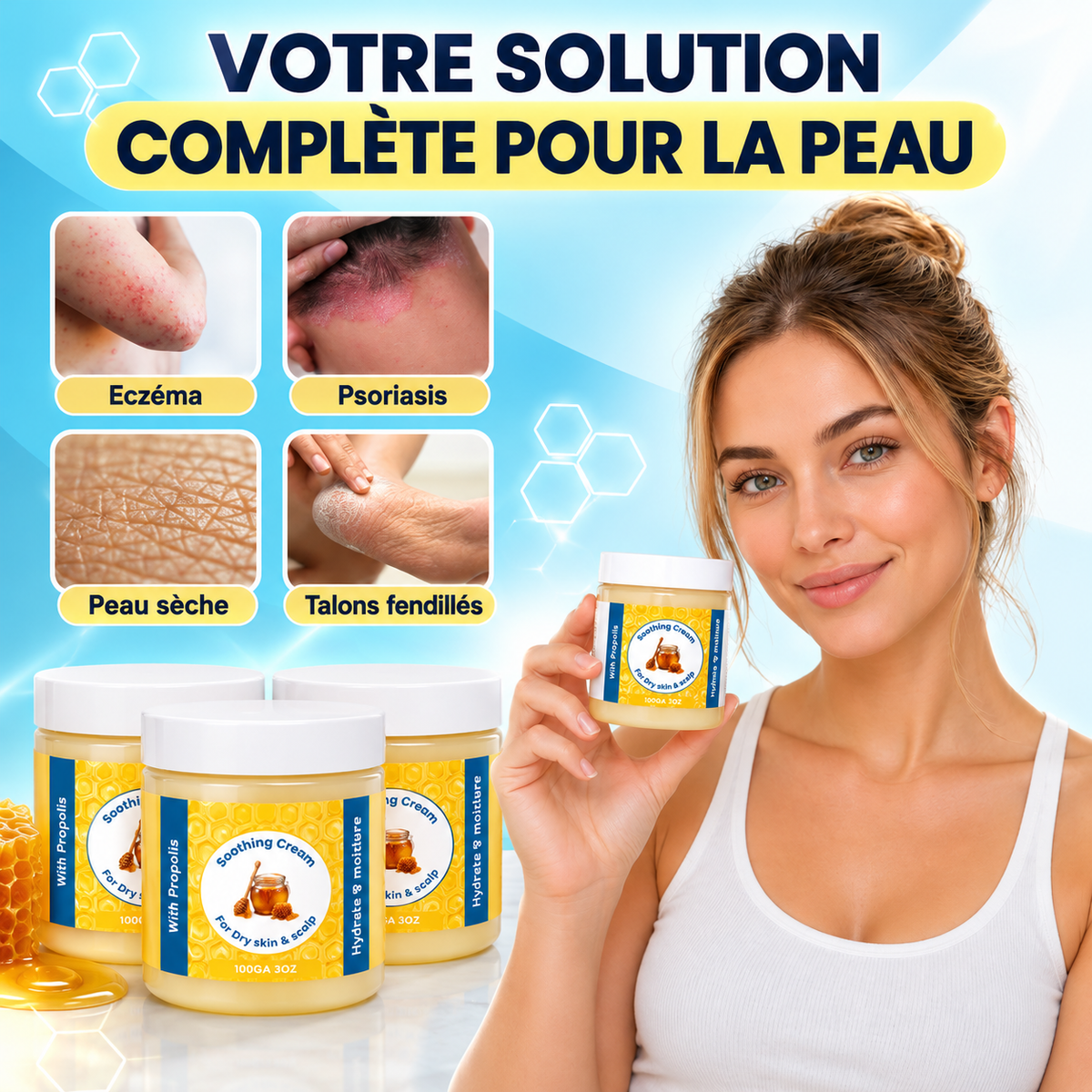 Baume Ondine – Soin naturel pour eczéma et psoriasis