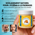 Baume Ondine – Soin naturel pour eczéma et psoriasis