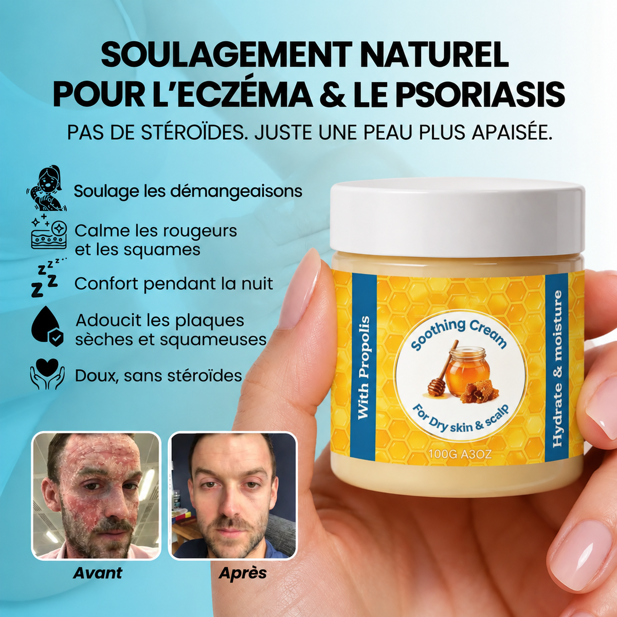 Baume Ondine – Soin naturel pour eczéma et psoriasis