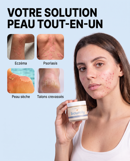 Baumly- Baume Peaux Sensibles