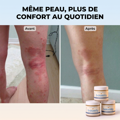 Baumly- Baume Peaux Sensibles
